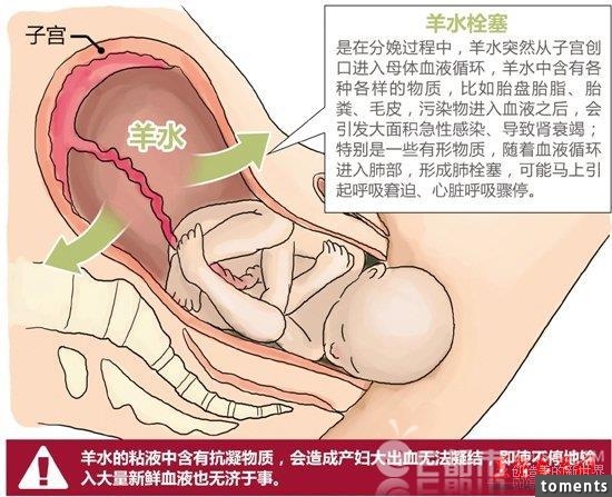 分娩後23歲產婦有說有笑卻突然去世，背後真相令人不解！心痛