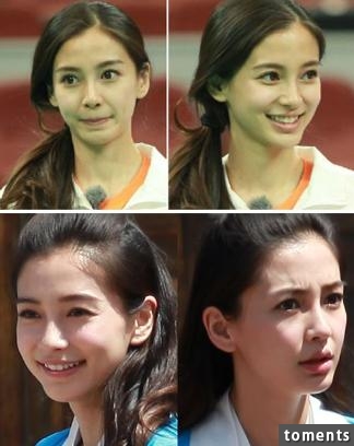 在這些證據面前，Angelababy做千萬次整容鑑定也沒用了