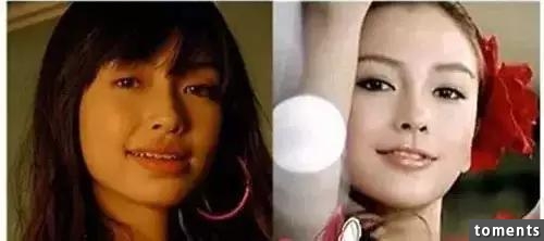 在這些證據面前，Angelababy做千萬次整容鑑定也沒用了