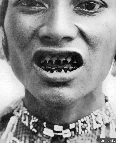 Some tribes sharpen and file down their teeth...