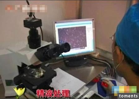 囧！這名丈夫竟把自己妻子的人工受孕全程曝光...！當太太看到這些畫面後瞬間就崩潰了！