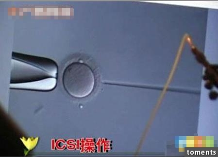 囧！這名丈夫竟把自己妻子的人工受孕全程曝光...！當太太看到這些畫面後瞬間就崩潰了！
