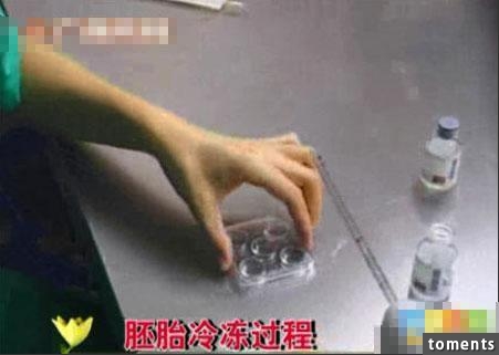 囧！這名丈夫竟把自己妻子的人工受孕全程曝光...！當太太看到這些畫面後瞬間就崩潰了！