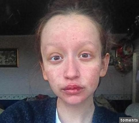 17歲女孩只因為吃了這個超普通的東西后！她竟然變成這副樣子！