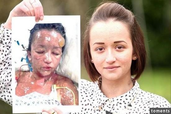 17歲女孩只因為吃了這個超普通的東西后！她竟然變成這副樣子！