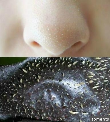4大招讓黑頭永遠消失!毛孔變小了!粉刺痘痘通通不見了!太棒了一定要學起來!