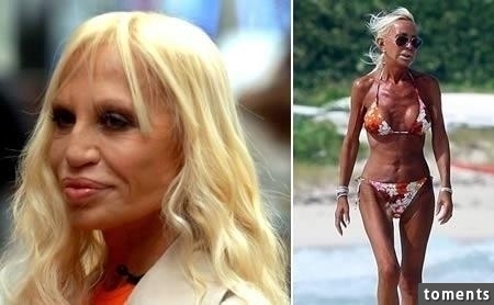 嚇!14個女人整形失敗案例,尤其第8個,完全毀了我童年記憶!!
