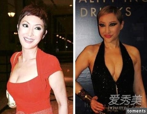 嚇!14個女人整形失敗案例,尤其第8個,完全毀了我童年記憶!!