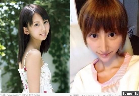嚇!14個女人整形失敗案例,尤其第8個,完全毀了我童年記憶!!