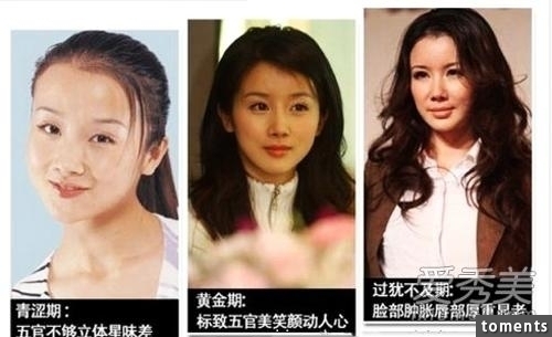 嚇!14個女人整形失敗案例,尤其第8個,完全毀了我童年記憶!!