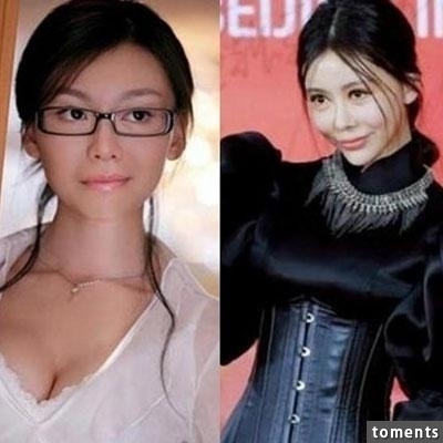 嚇!14個女人整形失敗案例,尤其第8個,完全毀了我童年記憶!!