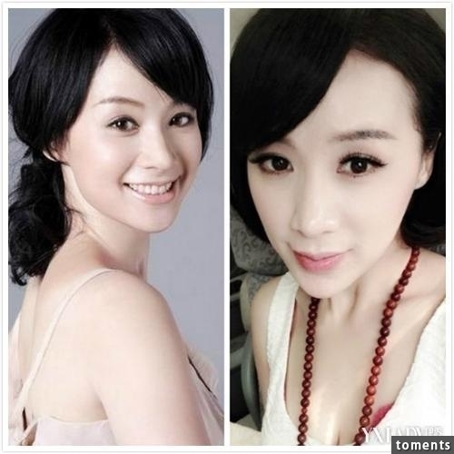 嚇!14個女人整形失敗案例,尤其第8個,完全毀了我童年記憶!!