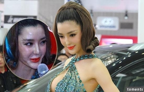 嚇!14個女人整形失敗案例,尤其第8個,完全毀了我童年記憶!!