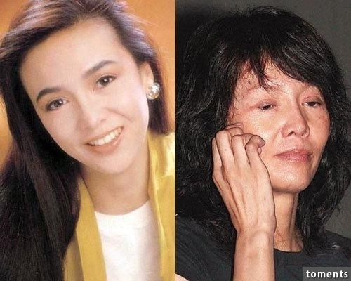 嚇!14個女人整形失敗案例,尤其第8個,完全毀了我童年記憶!!