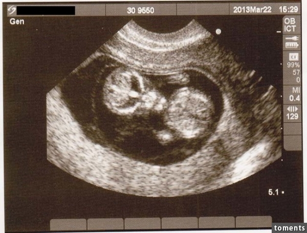Alien baby?