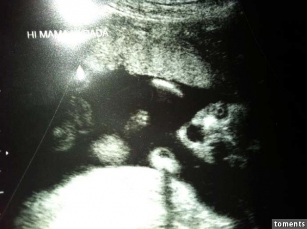 This baby looks like the villain from <em>Saw</em>.