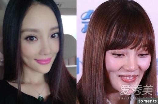 原來的她外貌可愛動人，整容隆胸後卻把自己的明星大道給毀了