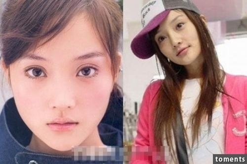 原來的她外貌可愛動人，整容隆胸後卻把自己的明星大道給毀了