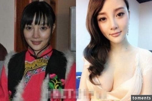 原來的她外貌可愛動人，整容隆胸後卻把自己的明星大道給毀了