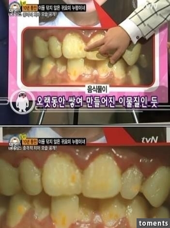 韓國美女美容師竟然10年沒刷過牙了？一開嘴直接.....太噁心了！！！