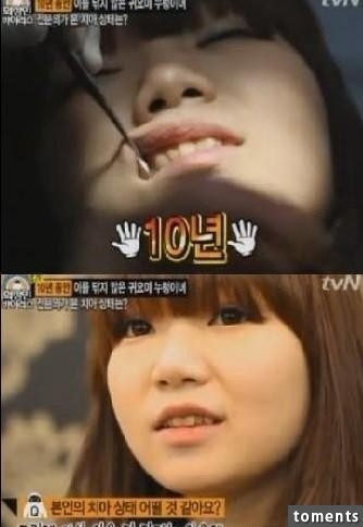 韓國美女美容師竟然10年沒刷過牙了？一開嘴直接.....太噁心了！！！