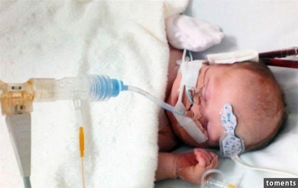 媽媽的預產期已經過了一個禮拜,沒想到剖腹產後竟看到淒慘的畫面