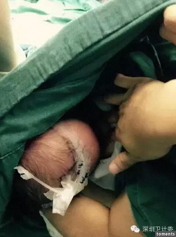 嬰兒在手術室哭鬧不停,她將嬰兒抱起後當場撩起衣服感動了全世界